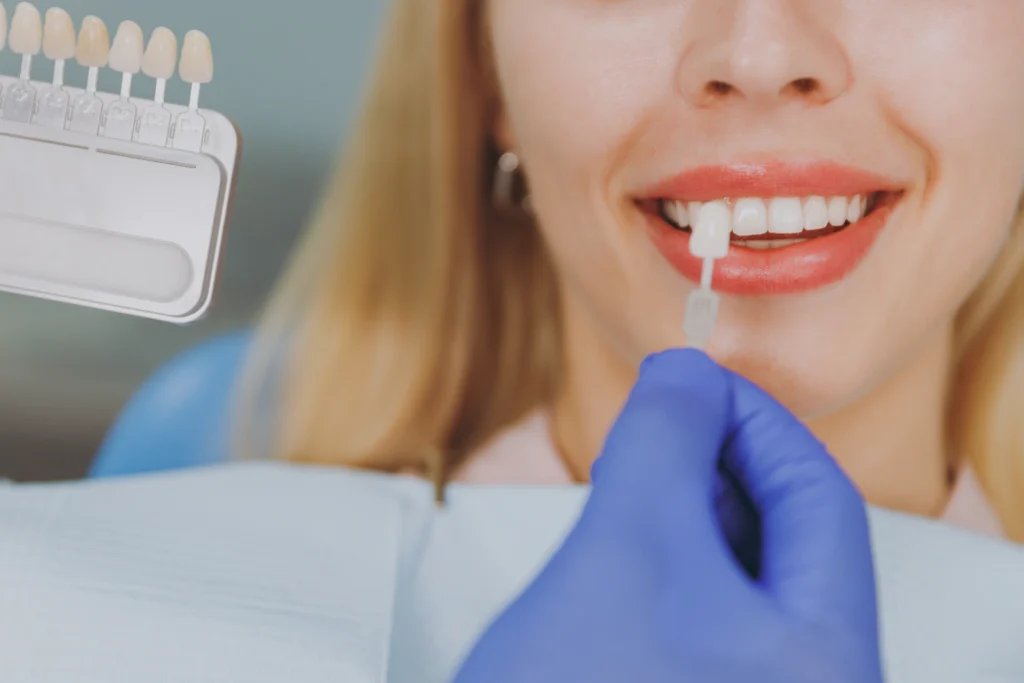 Close up cropped young smiling woman choosing veneers enamel color compare teeth shade with stomatologist sit at dentist office chair indoor light modern cabinet Healthcare enamel whitening treatment