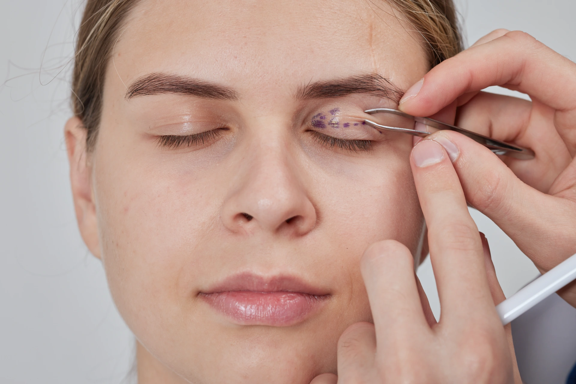 plastic surgeon prepares for Blepharoplasty, Blepharoplasty operation