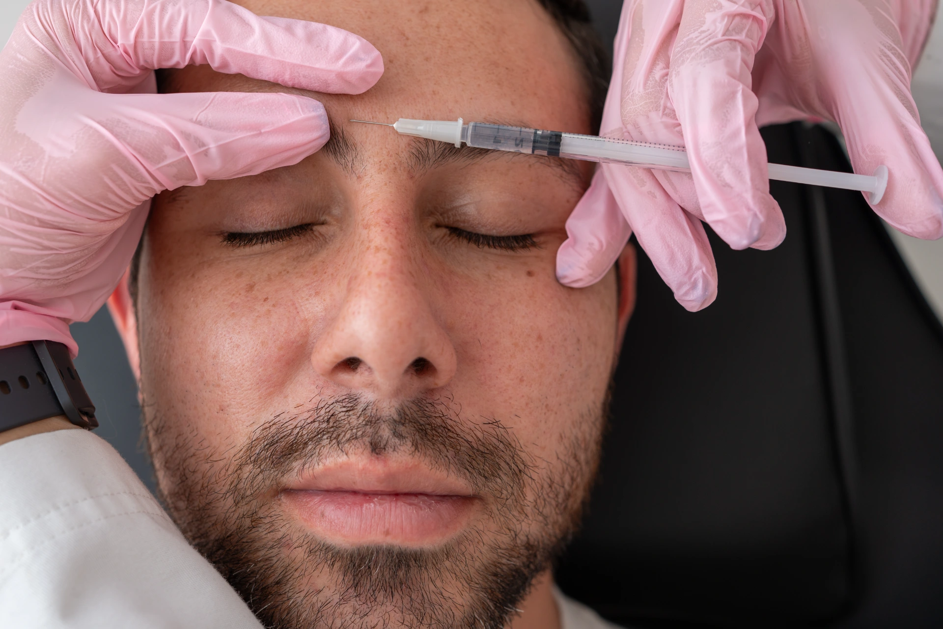 Close Up: Doctor Administering Botulinum toxin, Applying Wrinkle Treatment for Frown Lines on Male Patient's Face for Skin Care and Beauty