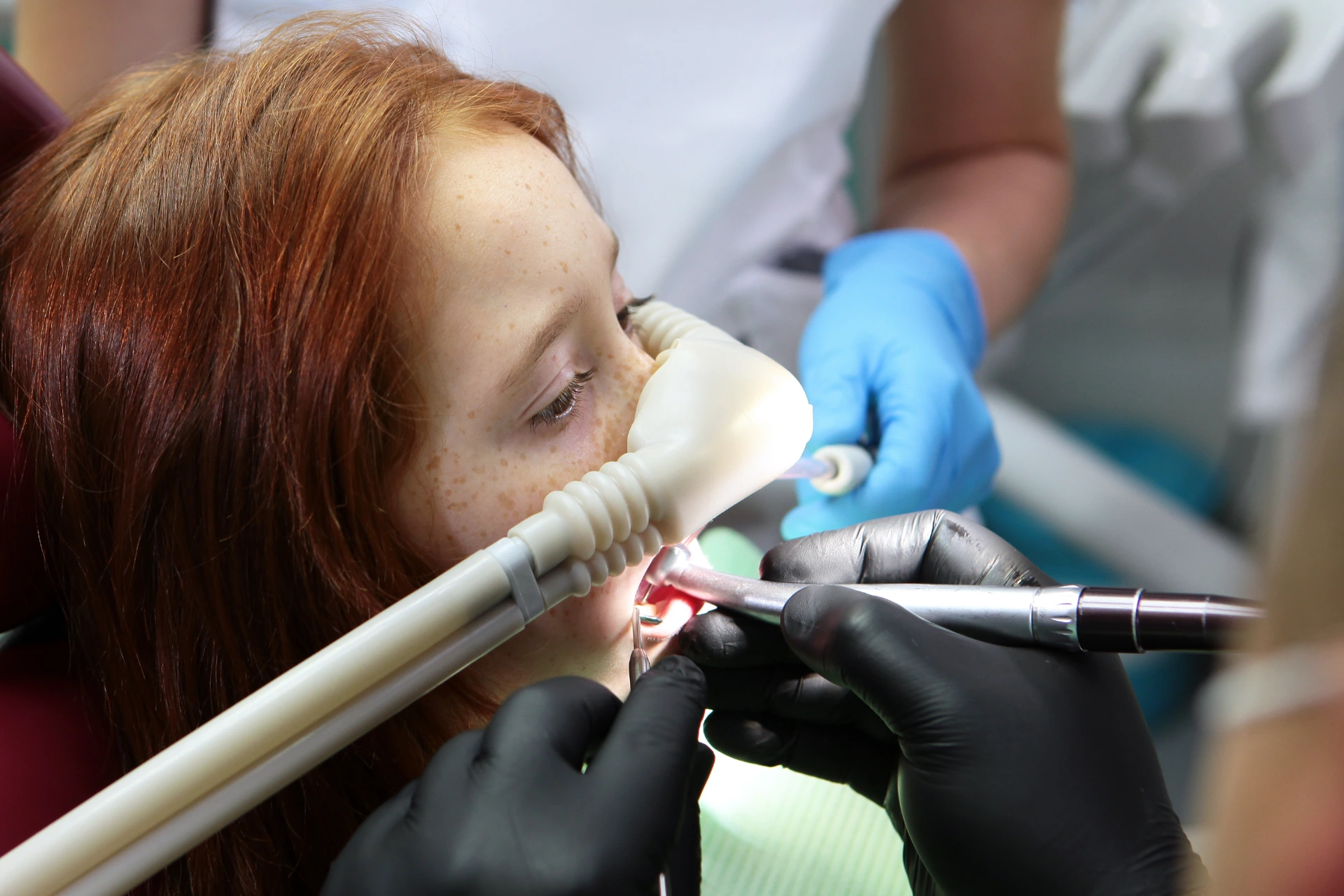 Dental treatment in child with sedation. Little girl is injected with an inhalation sedative during dental treatment at dental clinic.