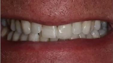 perfect healthy white teeth