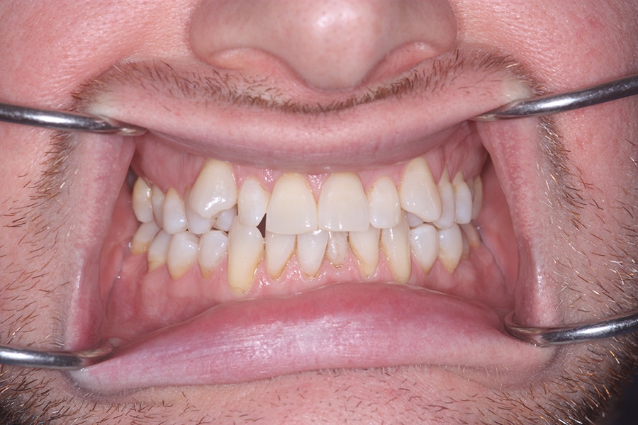 Before-11.jpg
