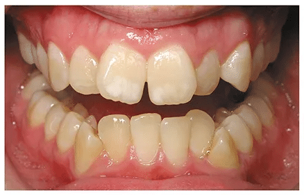 brace1-webp-900×300-.png