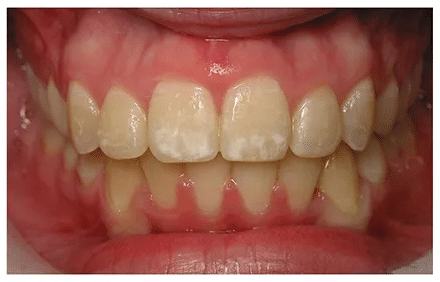 brace1-webp-900×300-1.png