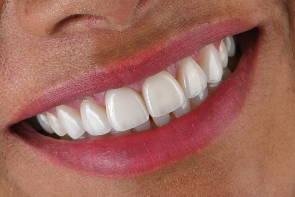 Cosmetic Dentistry in Stoke-on-Trent